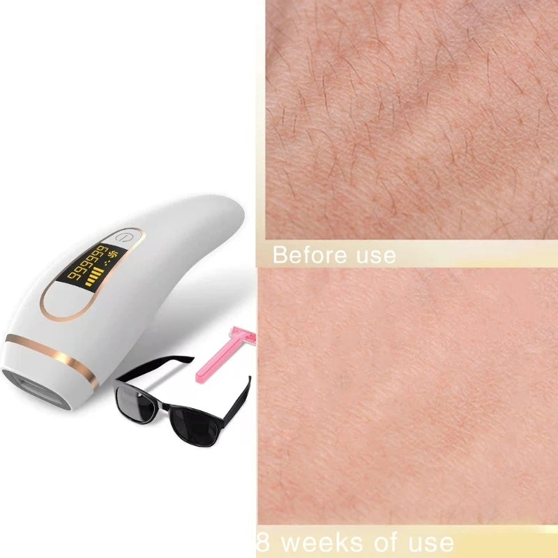 Lasers Hair Removal for Women Men IPL Hair Removal for Nearly Painless Lasting Flat-Head Window for Body Face Home Use